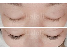 ラロリ(Laloli)/LED【バインドロック】100束