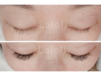 ラロリ(Laloli)/LED【バインドロック】100束