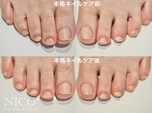 ニコプラス(NICO+)/爪育ネイルケア