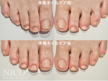 ニコプラス(NICO+)/爪育ネイルケア