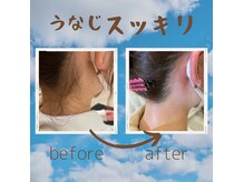 リソ ワキシング サロン(Liso waxing salon)の雰囲気（人気のうなじワックス脱毛☆施術時間約30分 ）