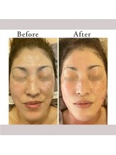 ロッシュ フェイス(Roche Face)/50代女性