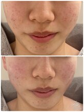 リッチベル(richbelle)/