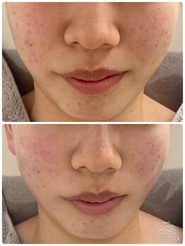 リッチベル(richbelle)/