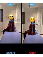 松戸駅前鍼灸院 整骨院/6月の新患様/骨盤の歪み/腰痛