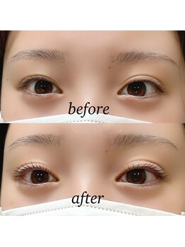 アイ(_i)/ラッシュリフト