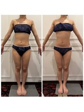 心斎橋 ルヴィ(REVI)/ボディ/痩身エステ/ダイエット