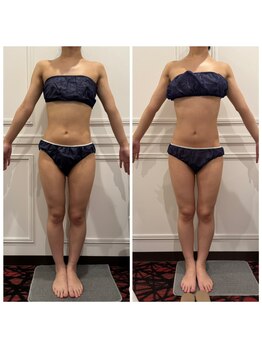 心斎橋 ルヴィ(REVI)/ボディ/痩身エステ/ダイエット