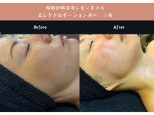 アクアビューティー 金沢(Aqua Beauty)