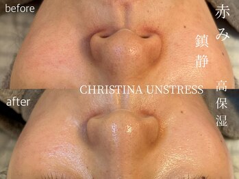 シェア(share.)/つやつや超艶肌トリートメント