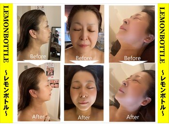 サロンフィーユ(Fille)/60代からの「美」への挑戦