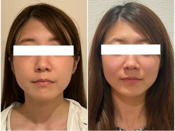 ウェリナ平和堂長久手院/小顔矯正/骨盤矯正/美脚サロン