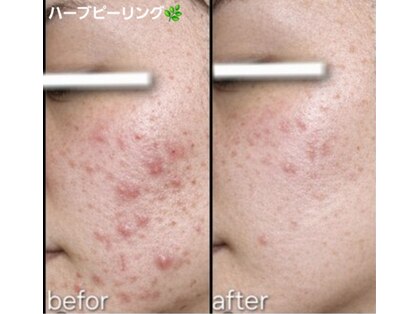 マロン(MARON)の写真