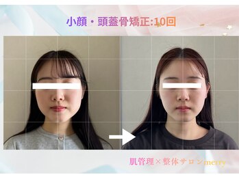 メリー 大和西大寺店(merry)/小顔・頭蓋骨矯正Before after★