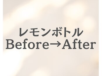イーラボ 池袋店(e-LABO)/レモンボトル+ラジオ波Lift