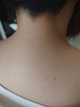 リール ヴィー(Rire Vie)/後ろ姿美人コース &nbsp;&nbsp;&nbsp;アフター