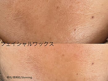 スタニング(Stunning.)/フェイシャルワックス