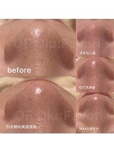 オフオルファヴォリ(OF Olu:Favori)/【韓国式３D毛穴洗浄】