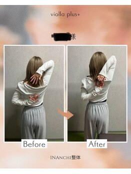 ヴィオラプラス(violla Plus+)/巻肩矯正
