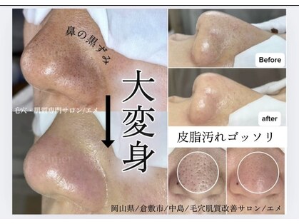 エメ(Aimer)の写真