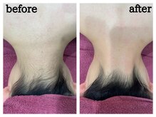 ファビリス 仙台ロフト店(FAVILIS)/【脱毛】襟足脱毛月1回合計10回