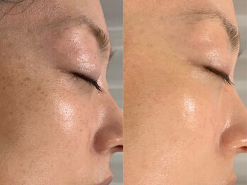 グラス マチネ(La grasse matinee)