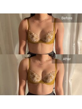 ハートランド(HEARTLAND)/プチ・クレオパトラで左右差