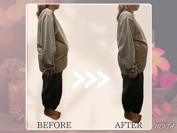 ネクシア 恵比寿(NEXIA EBISU)/妊婦さんのお腹ビフォーアフター