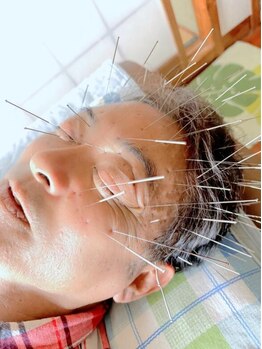 眼精疲労を解消したい