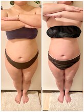 フーガ 宇都宮店(fu-ga)/やみつき 美骨リンパマッサージ