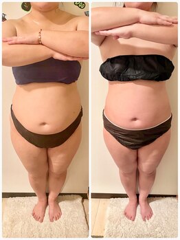 フーガ 宇都宮店(fu-ga)/やみつき 美骨リンパマッサージ