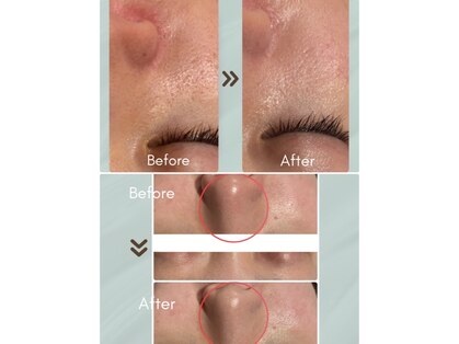 東京美肌管理サロン 六本木店の写真