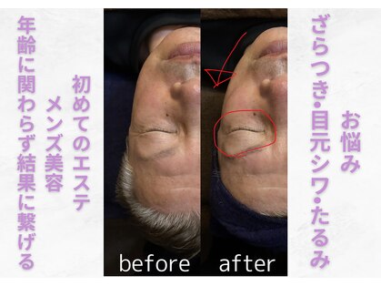 ニース(NICE)の写真