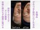 ニース(NICE)の写真