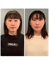 カナエルサロン 旭川(KANAERU SALON)/【小顔ケア】症例☆