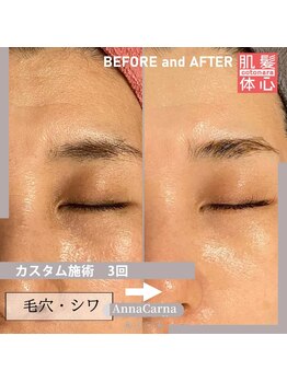 アンナカルナ(AnnaCarna)/目元と透明感で印象がスッキリ