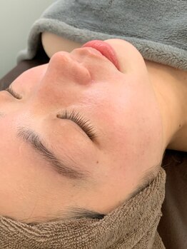 ハイディー(Hi-De)の写真/顔脱毛で毛穴の目立たない、キメ細かなキレイ肌に！毛穴レスで自信の持てる美しいお肌へ☆都度払い可◎