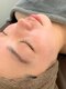 ハイディー(Hi-De)の写真/顔脱毛で毛穴の目立たない、キメ細かなキレイ肌に！毛穴レスで自信の持てる美しいお肌へ☆都度払い可◎