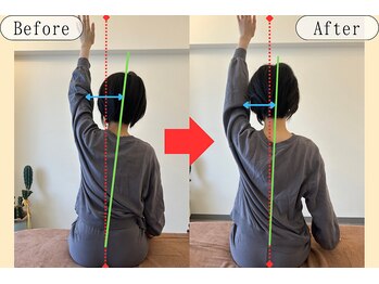 シェアハピネス たまプラーザ(share happiness)/Before＆After