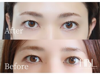 シャルリス(CHALELISS)/目元トータルHBL