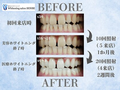 センス(SENSE)の写真