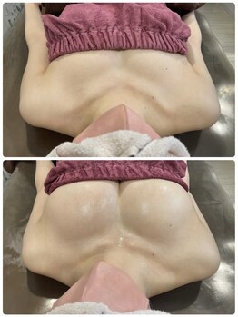 ロココ 岐阜店(Rococo)の写真/一人一人に合わせたオーダーメイドの劇的バストアップ◇どんなお胸もお任せあれ!!ふっくらマシュマロ胸に♪