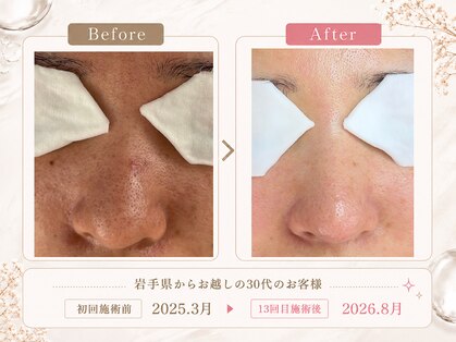 ミーシャイン(Miishine.)の写真