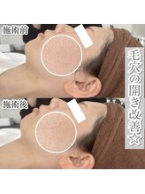 ぺルラ 島田駅前店(Perla)/光フェイシャル