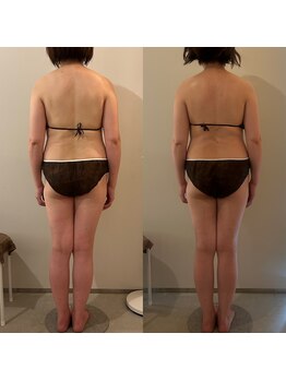 ラナ 京都西院店(Lana)/黄土漢方よもぎ蒸し＆マッサージ