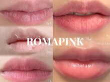 アンフェム(Anfem)/ローマピンク☆リップ