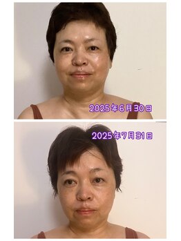 サロン ド ピラティス ラワンデル(salon de pilates)/小顔フェイシャルモニター