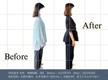 リビット 等々力(Rebit)/BeforeAfter,姿勢調整,首肩こり