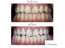 エヌエーホワイトニング たまプラーザ店(NAホワイトニング)/セルフホワイトニング/たまプラ