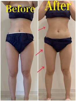 スペチアーレ 夙川/顔も体も大変身!